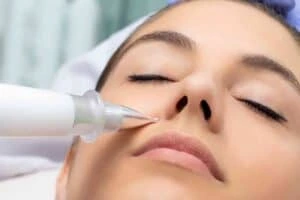 Best Actinic Keratoses Removal 3 Actinic keratoses Drayton solutions - book in today!