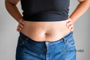 Bidding Farewell to Muffin Tops with Aqualyx Fat Injections 2 Do you wish you could reduce your muffin top Drayton With Aqualy fat dissolving injections you can!